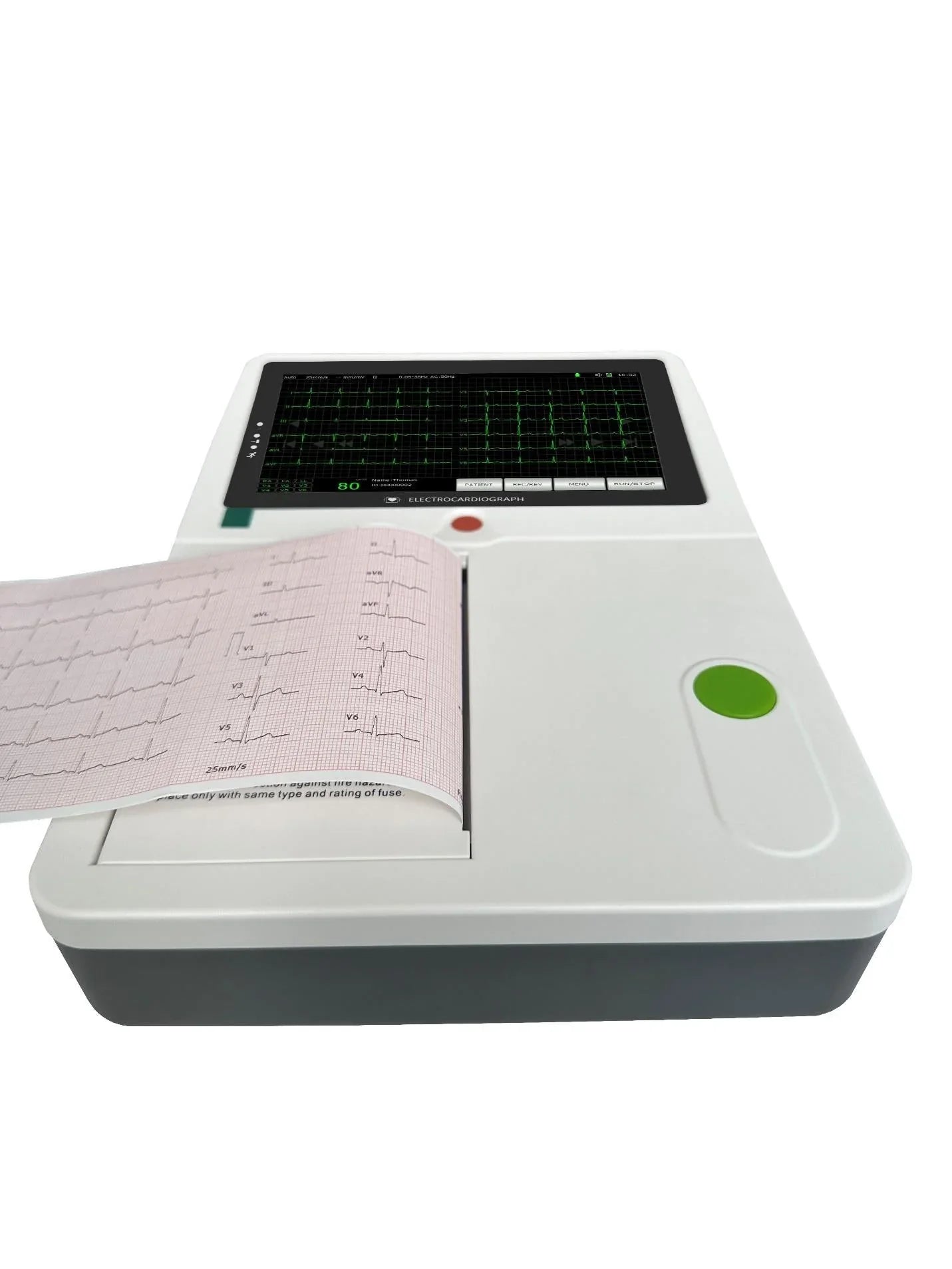 Electrocardiogram - ECG